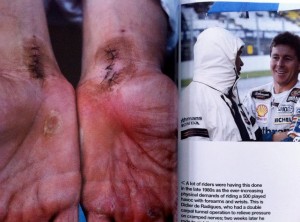 De Radigues hands
