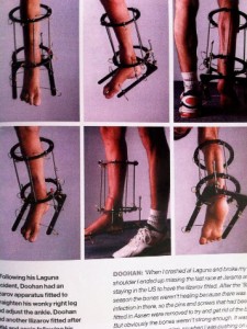 Doohans leg